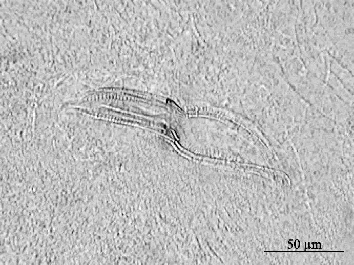 Structures of some widely distributed lung helminths (a)